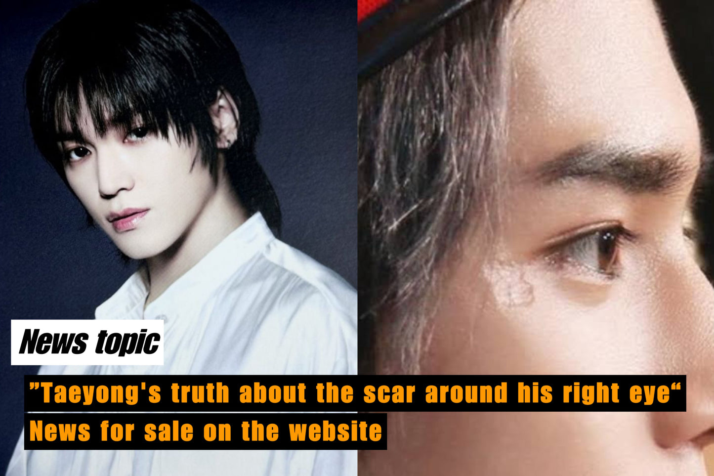 Taeyong about his scar near his right eye
